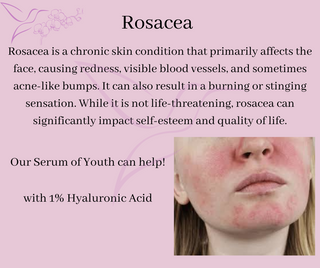 Rosacea